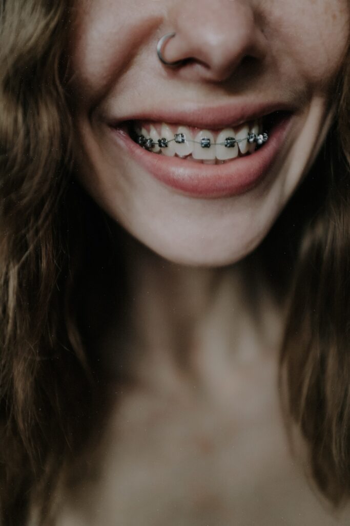 Brackets-1-683×1024