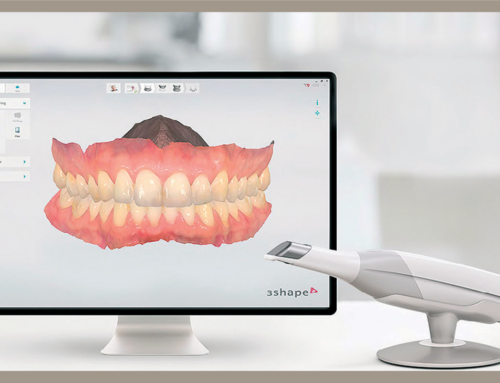 Escáner intraoral