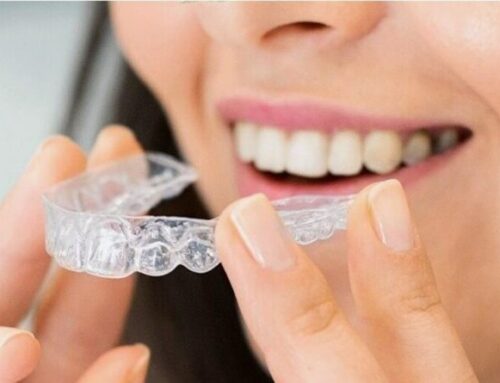Tratamiento de ortodoncia con alineadores o brackets